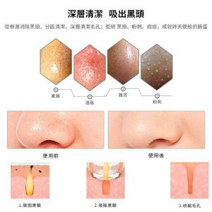 HSH0000035 ViuTV 熱賣可視無線吸黑頭粉剌機Lunon LUN08去除黑頭和毛孔中多餘的油脂 5 300x300