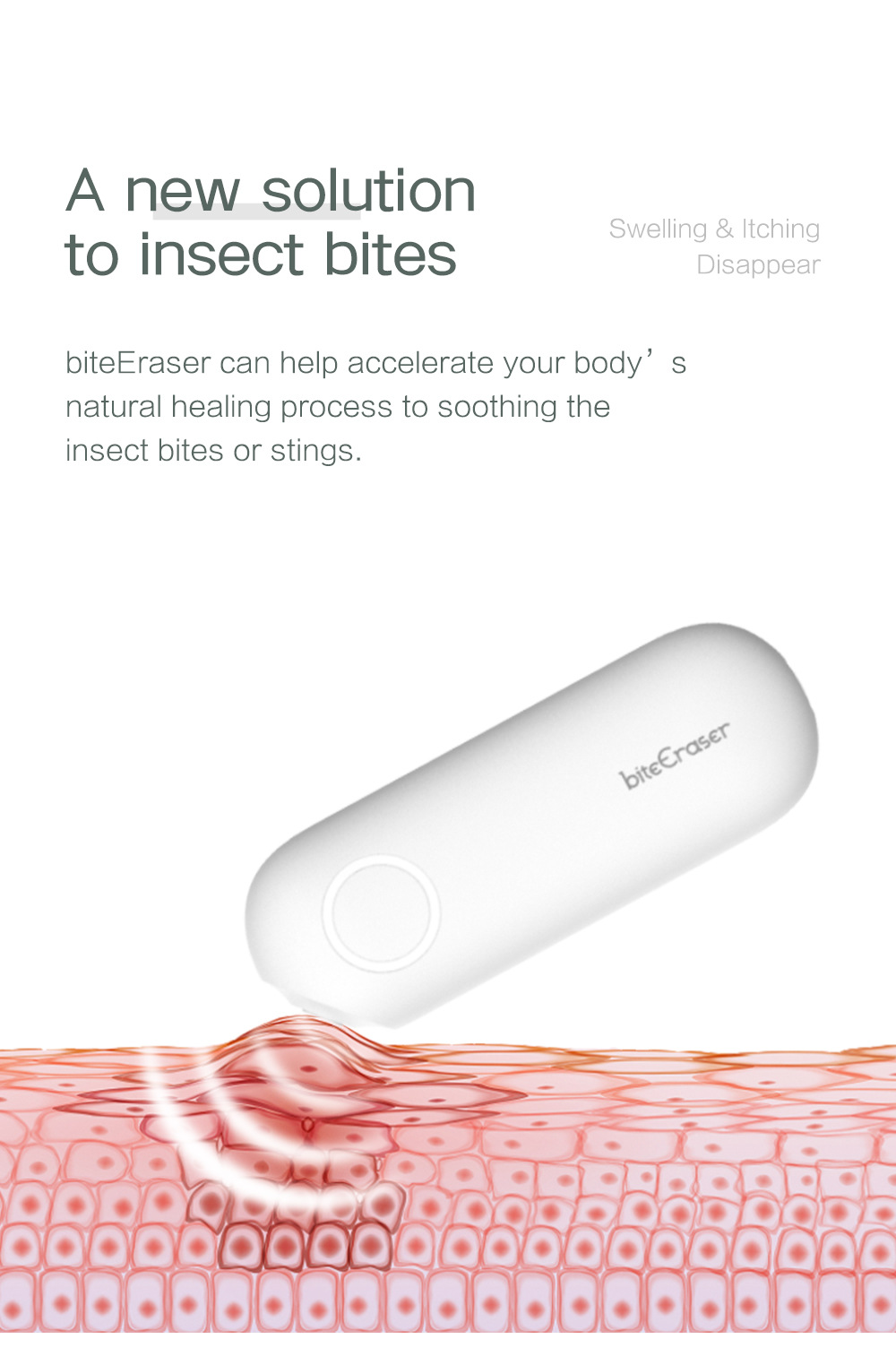 戶外止癢儀 O1CN018bG87Z234ZK4nPEar 1003187202 0 Cib