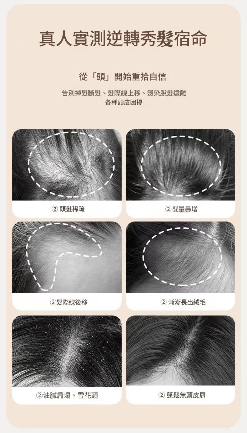 日本三井 巨無霸防脫髮洗髮水1000ml/支——強韌髮根,告別掉髮,重現豐盈秀髮! 14 2