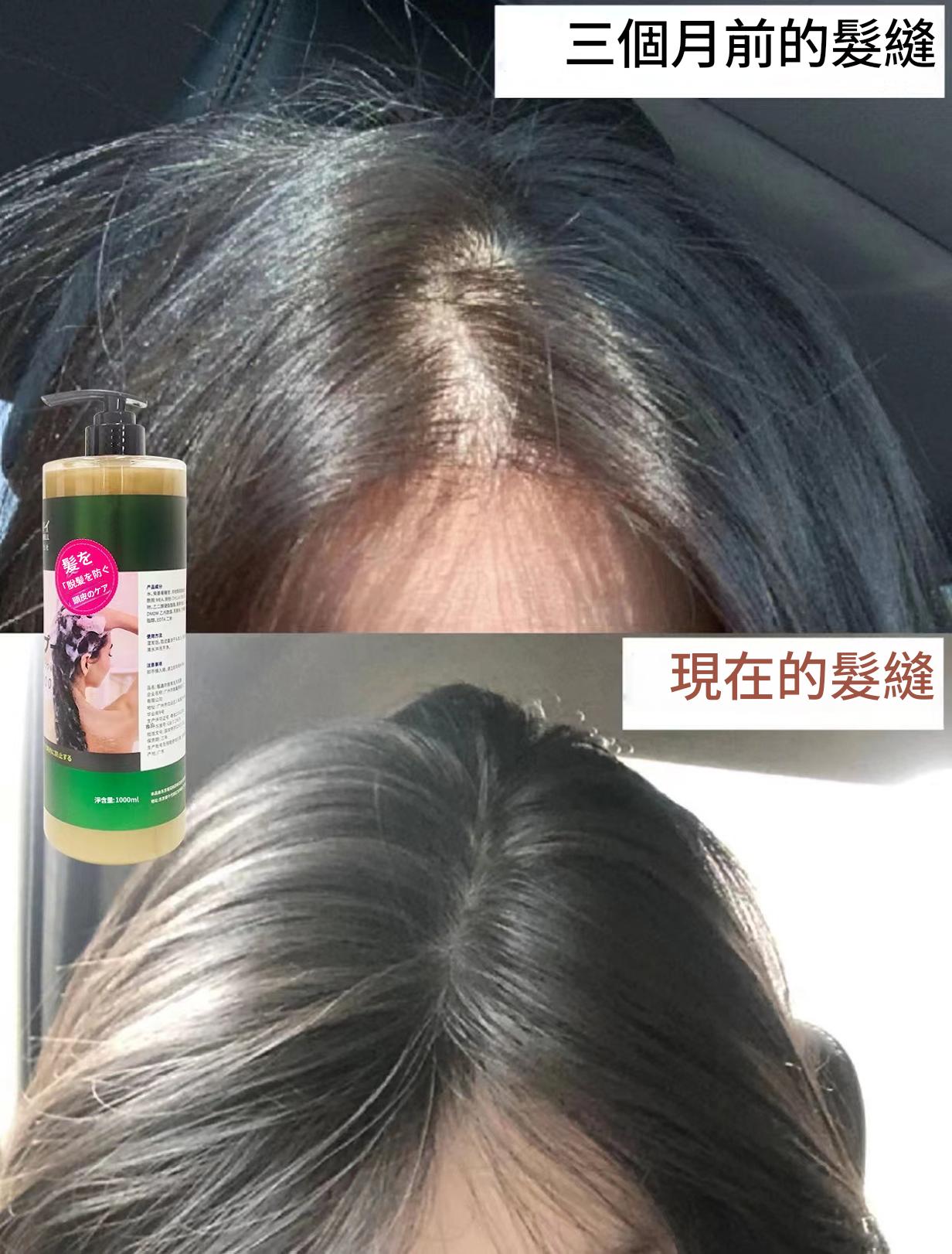 日本三井 巨無霸防脫髮洗髮水1000ml/支——強韌髮根,告別掉髮,重現豐盈秀髮! 7 4