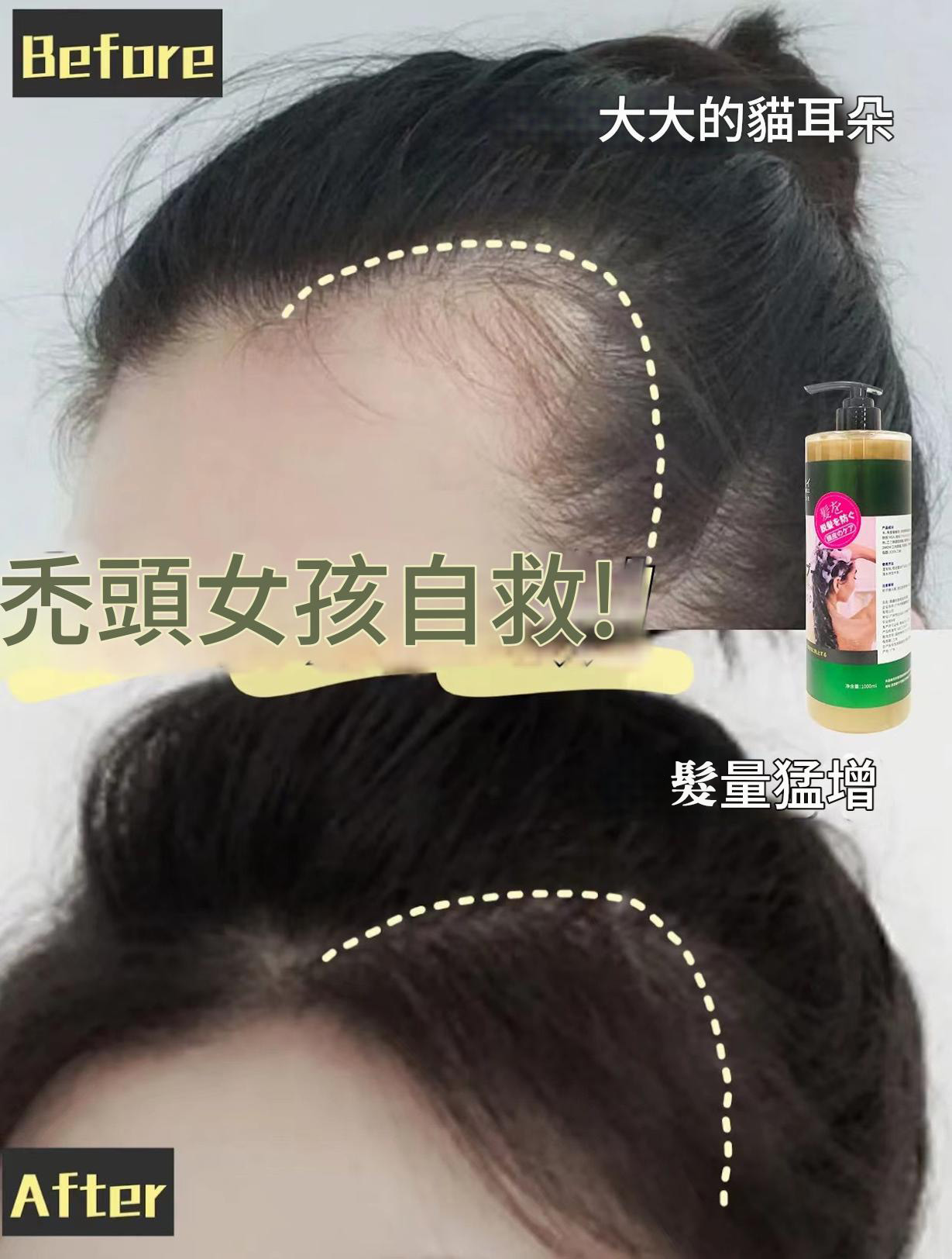 日本三井 巨無霸防脫髮洗髮水1000ml/支——強韌髮根,告別掉髮,重現豐盈秀髮! 8 4