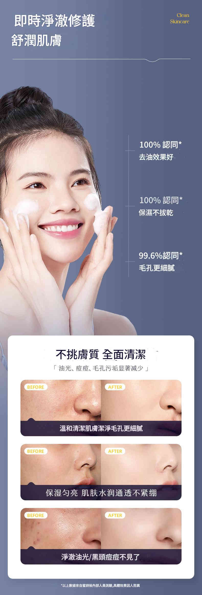 详情-19 🌸MYSCHOEN玻色因氨基酸潔面乳(100ml x2) - Image 5