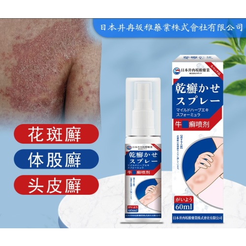 日本井冉坂稚牛皮藻菌止癢膏皮膚搔癢抑菌膏止癢用噴劑60mlX2