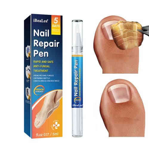 iBeaLee 指甲修復筆 – 天然草本配方，有效告別指甲真菌，重現健康光澤