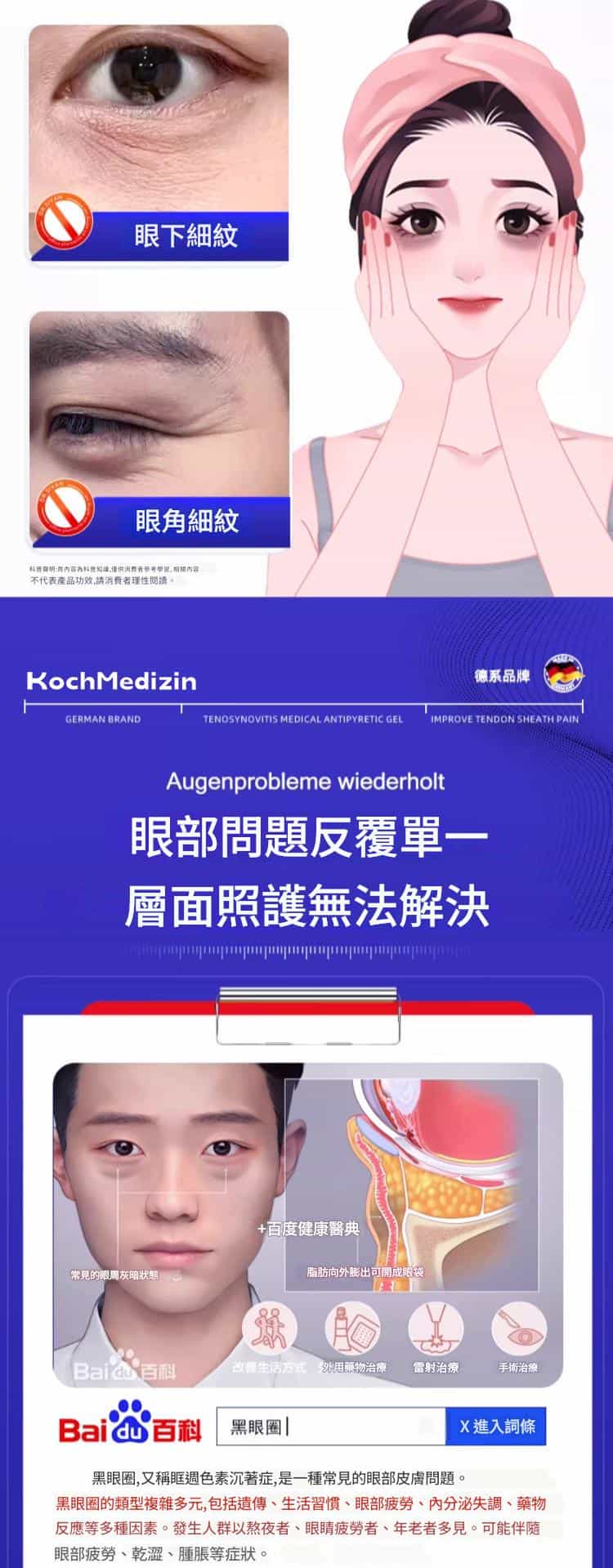 【德國Koch Medizin】黑眼圈修護霜 |300g/一瓶 B 2 52