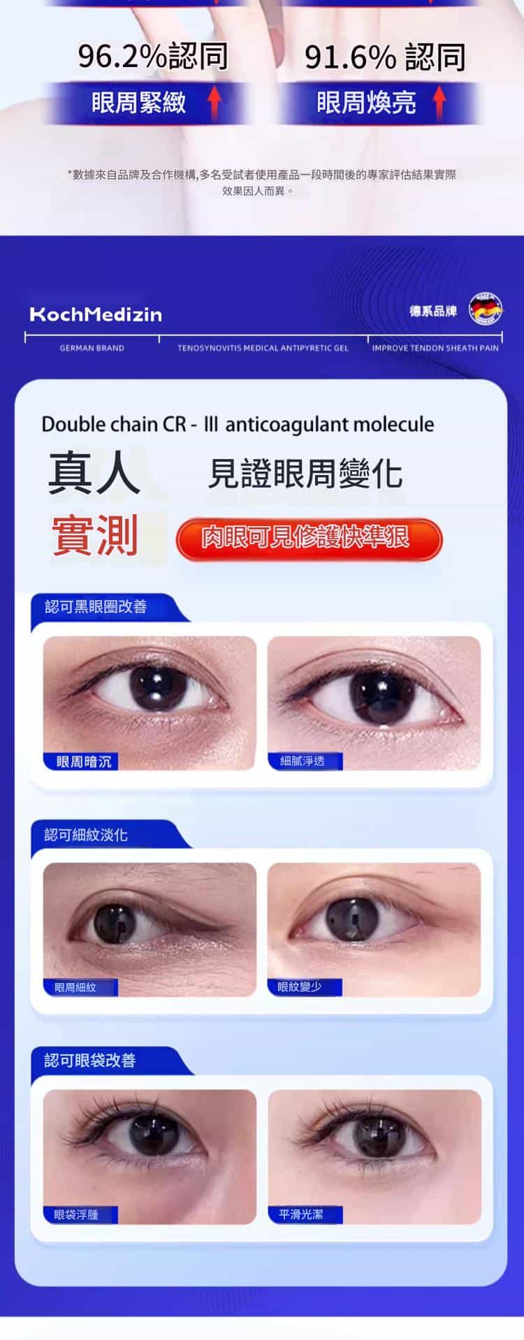 【德國Koch Medizin】黑眼圈修護霜 |300g/一瓶 B 4 53