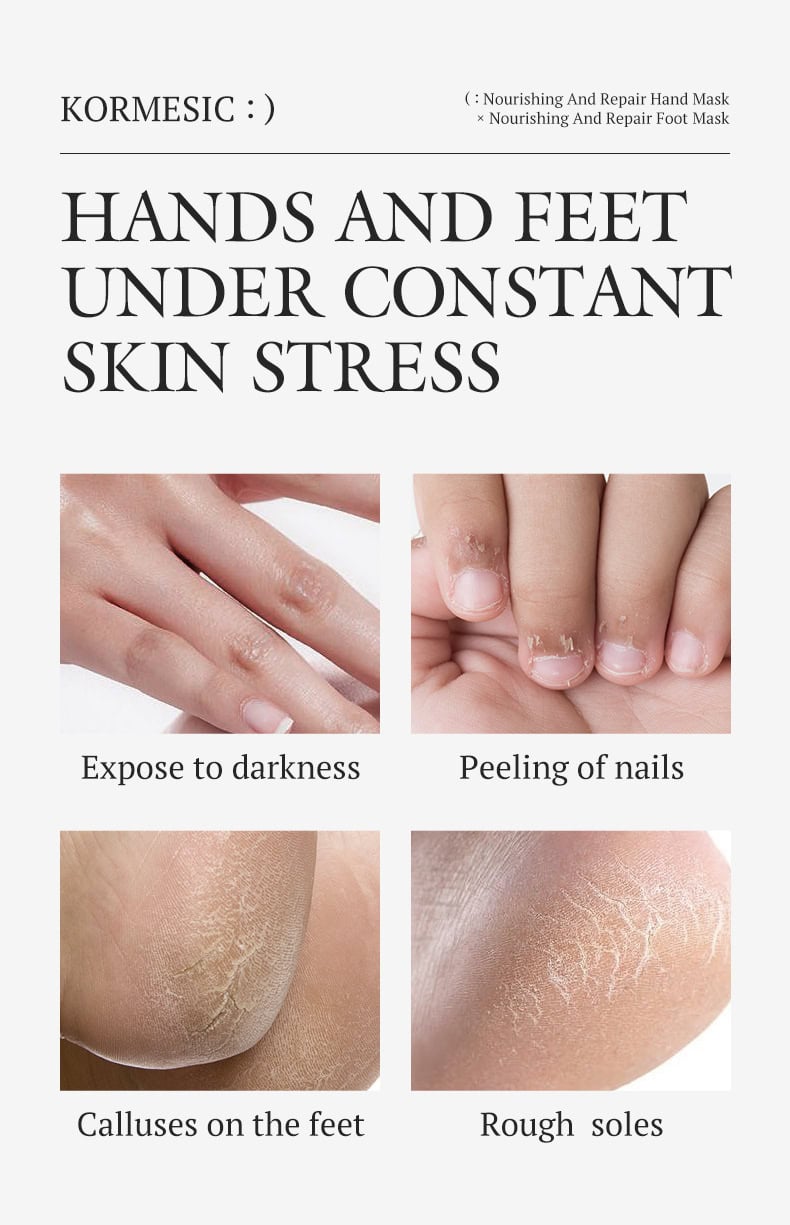 KORMESIC Handfootmask19