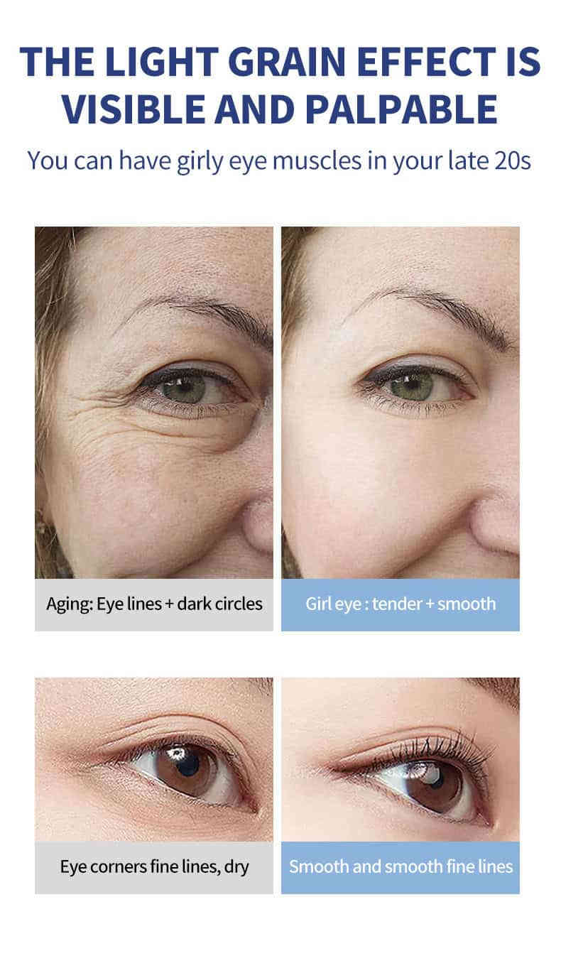 O'CHEAL 微震按摩抗皺眼霜 20g Ocheal MASSAGE EYE CREAM12