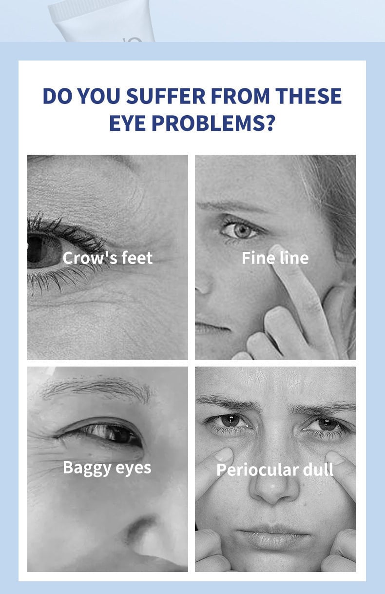 O'CHEAL 微震按摩抗皺眼霜 20g Ocheal MASSAGE EYE CREAM2