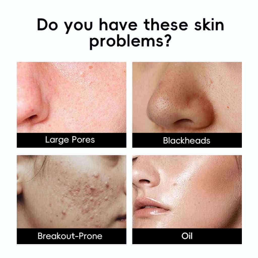 详情 15 32 1024x1024