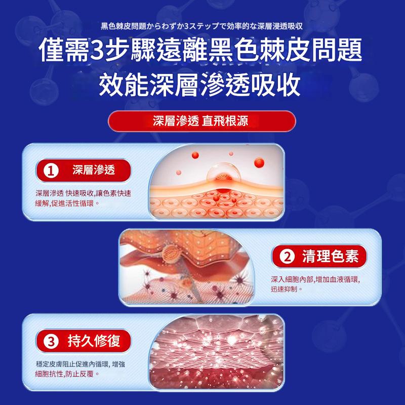 ( 日本 ) 岩井昃弘去黑色素沉澱脖頸關節藥膏 30g/瓶x2