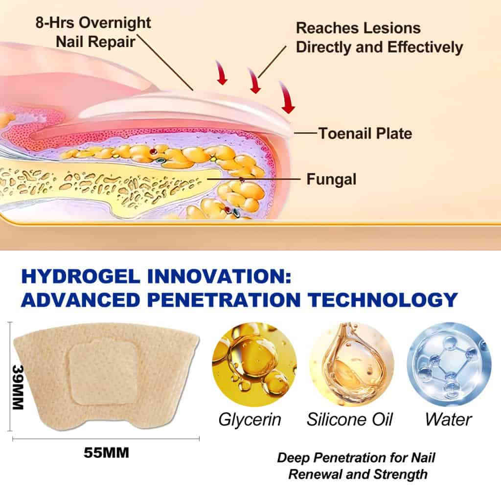 sefudun真菌甲貼片32片/包 灰指甲救星|水凝膠深層滲透|減少變色增厚