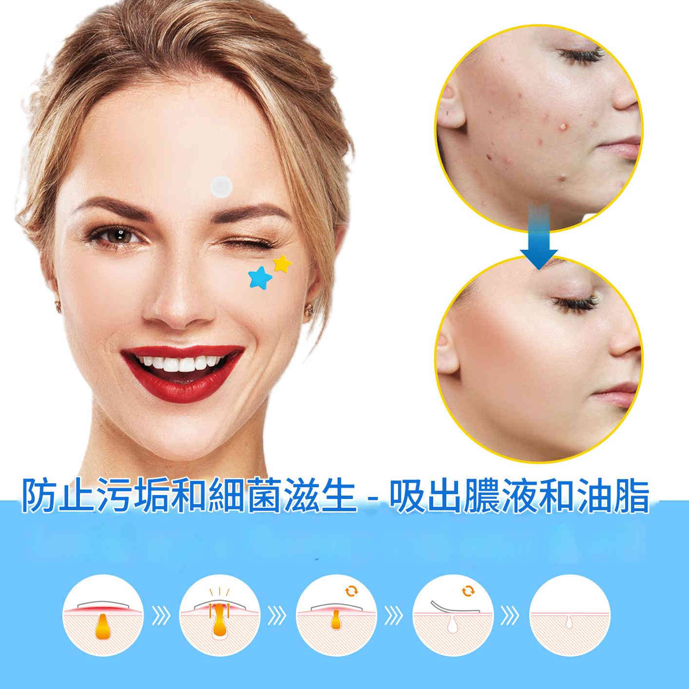 elaimei 茶樹油特效痘痘貼