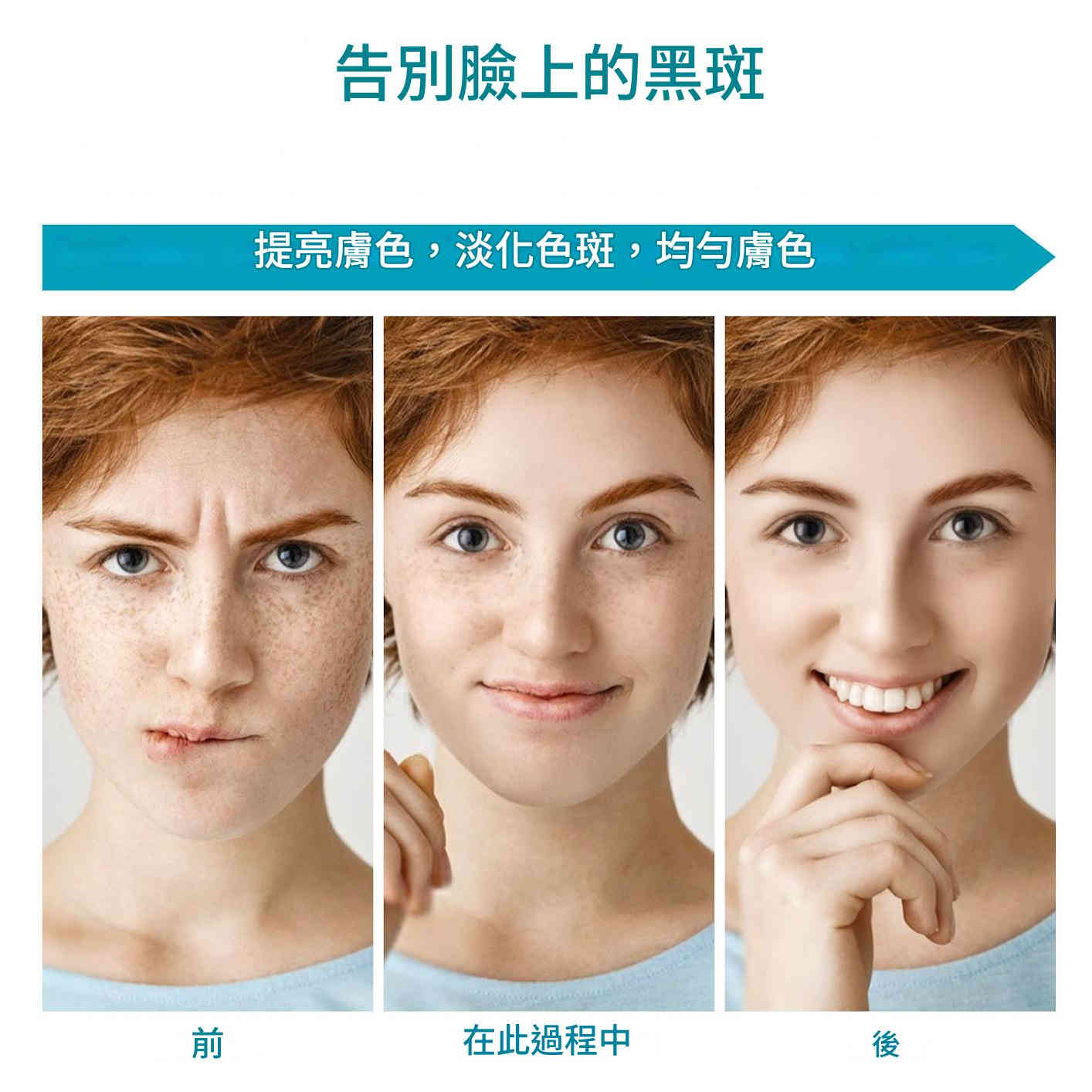 elaimei 玻尿酸三重功效面部淡斑修護霜 50ml/盒