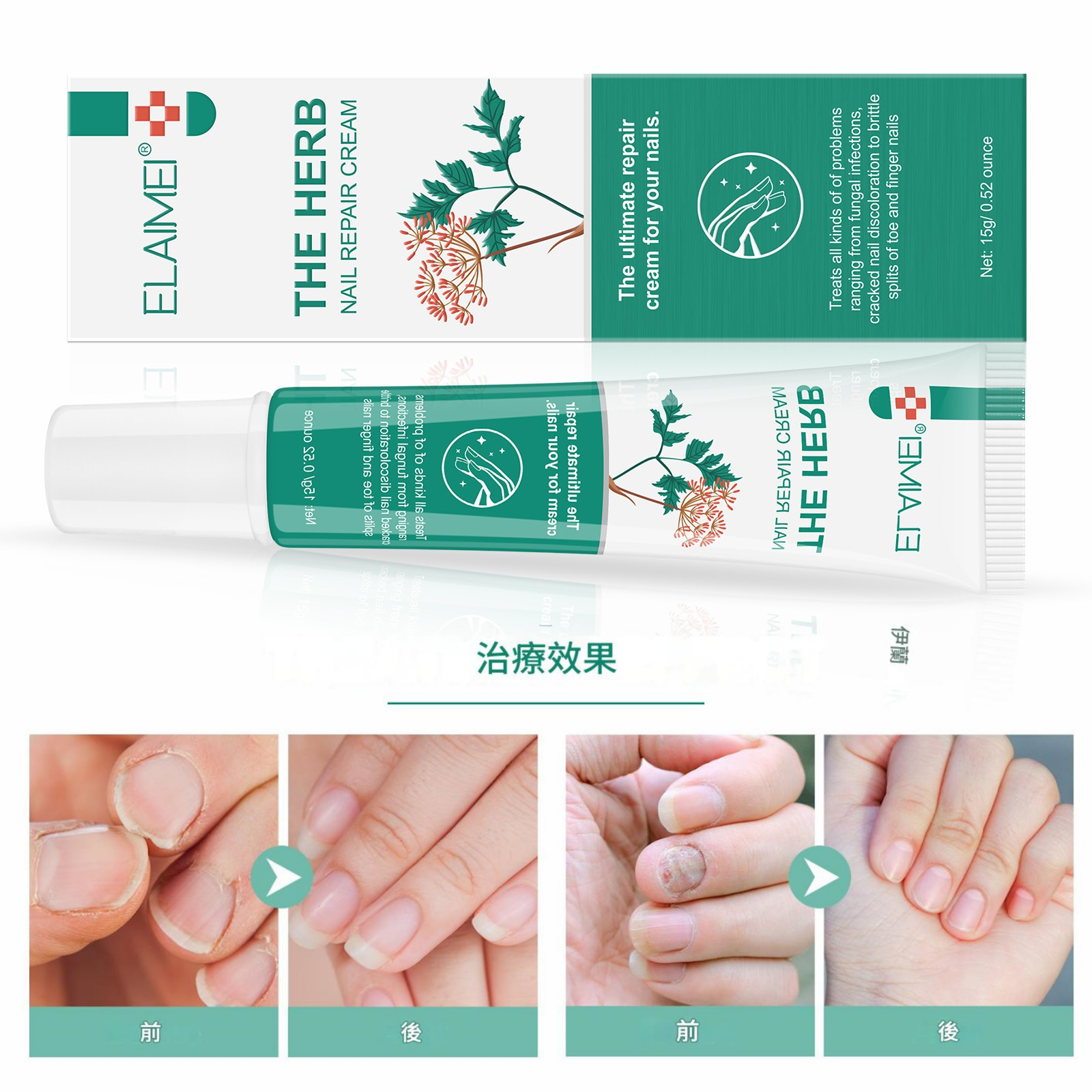 elaimei 草本攝取物指甲修復膏15ml/支x2