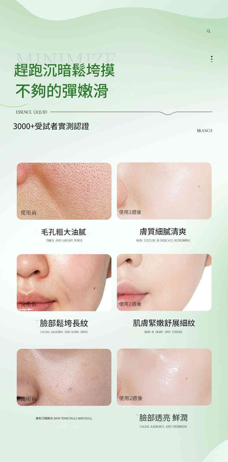 beiliing mei 水楊酸次拋祛痘收縮毛孔粉刺精華液 ( 一盒30支，每支1.5 ml)