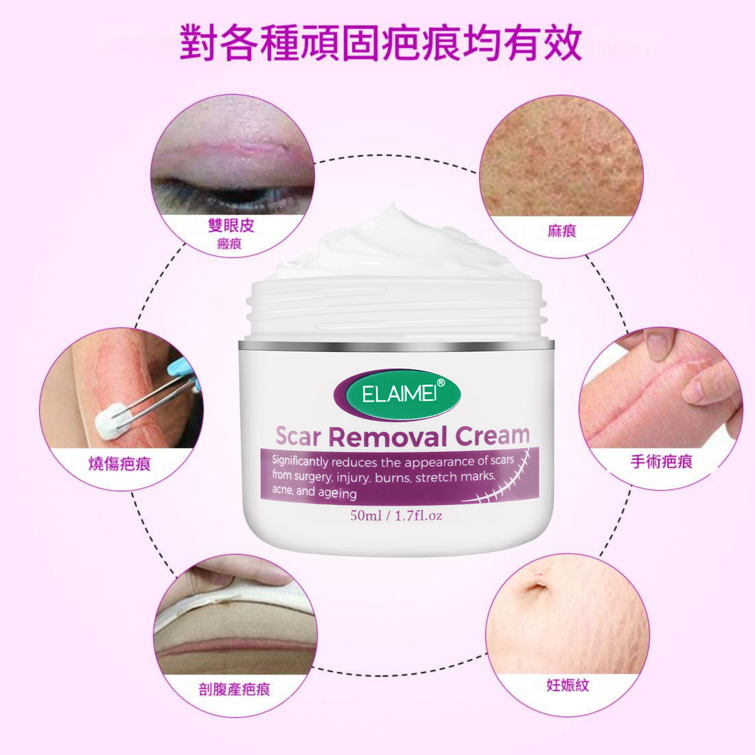 elaimei 積雪草提取物去疤痕膏50ml/盒