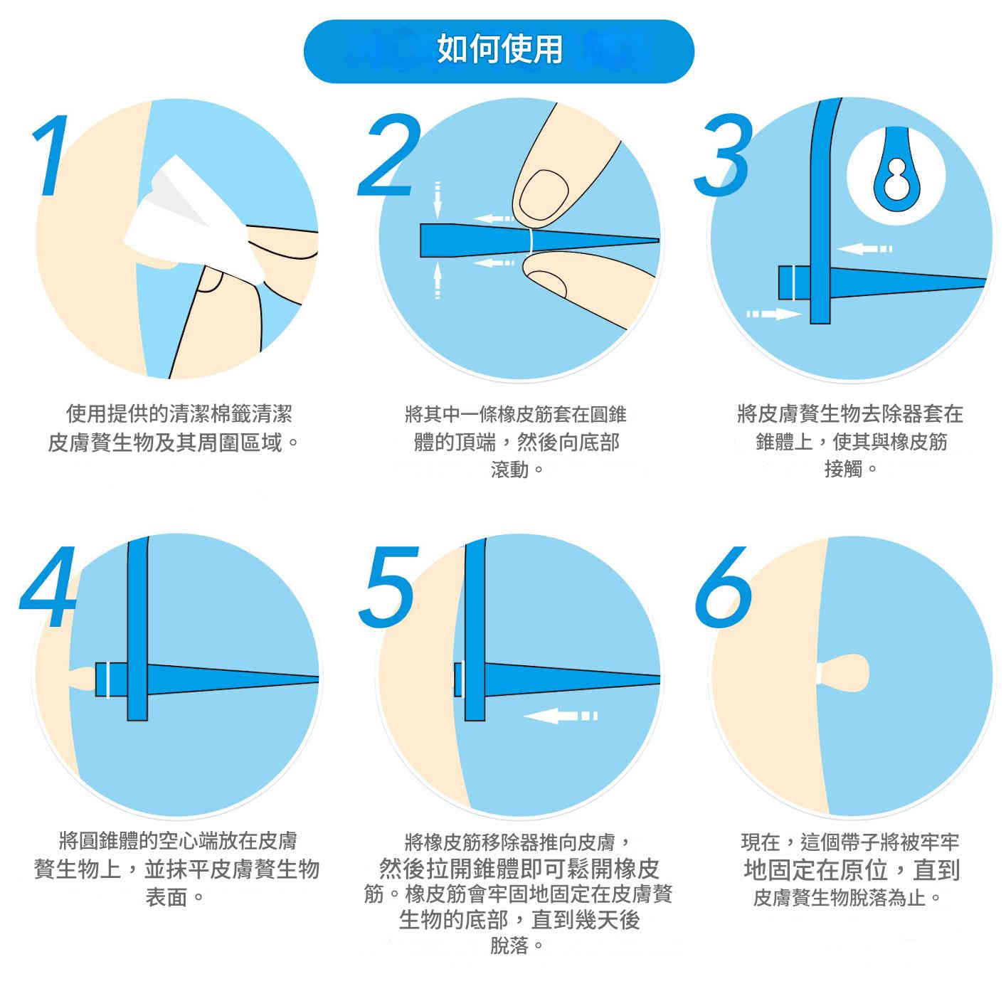 elaimei 2 合1 皮膚疣去除工具套件