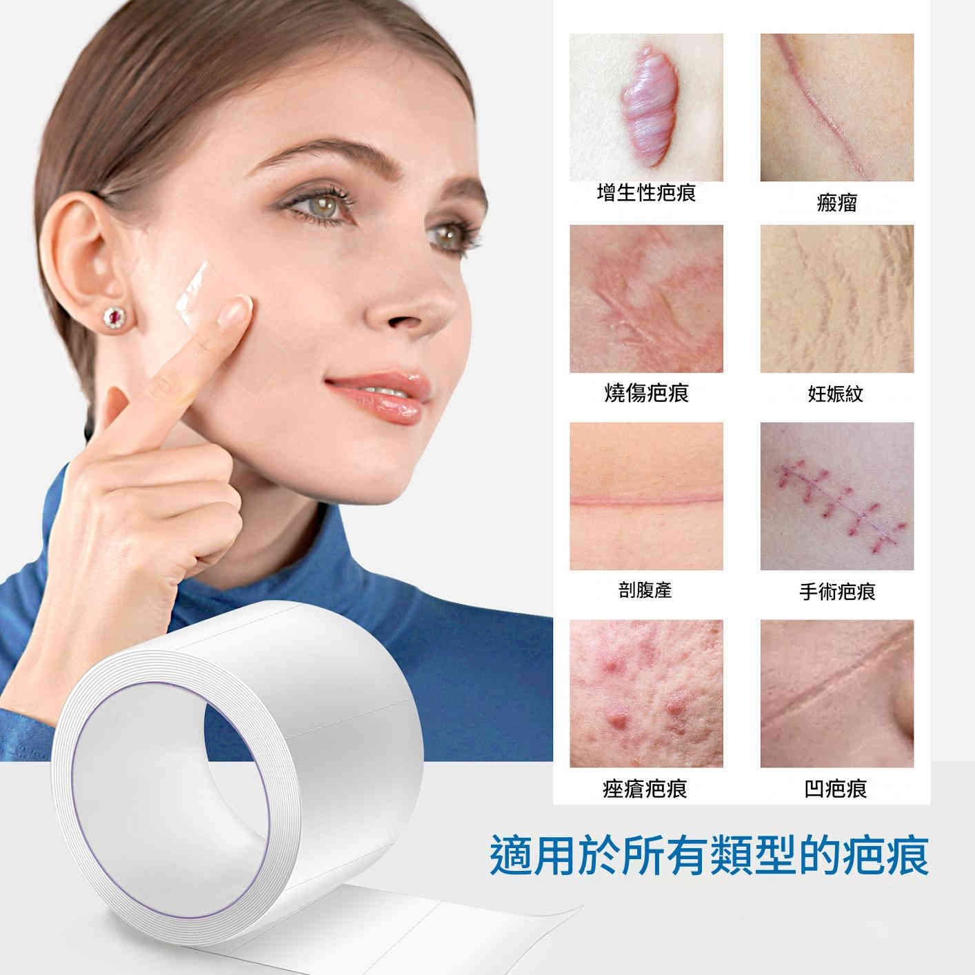 elaimei 專業醫療級透明矽膠疤痕貼x2