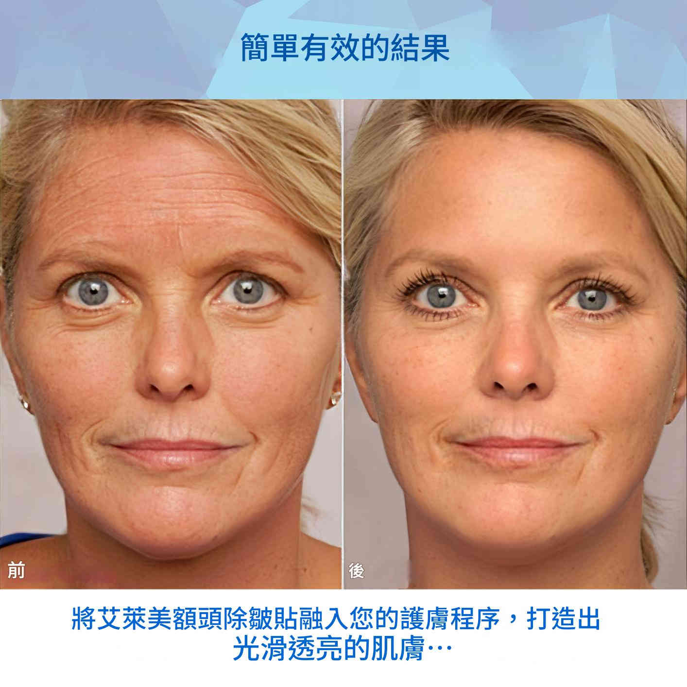 elaimei 蘆薈加膠原蛋白額頭抗皺貼片（一盒16貼）