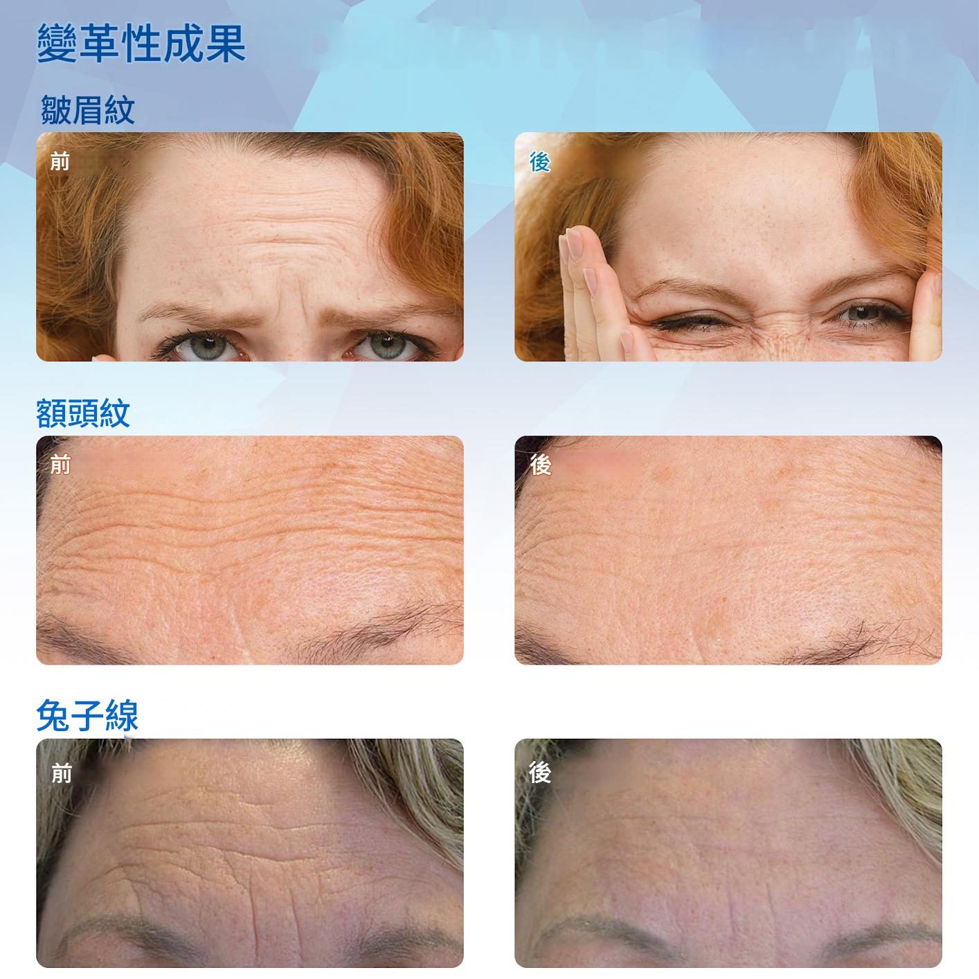 elaimei 蘆薈加膠原蛋白額頭抗皺貼片（一盒16貼）