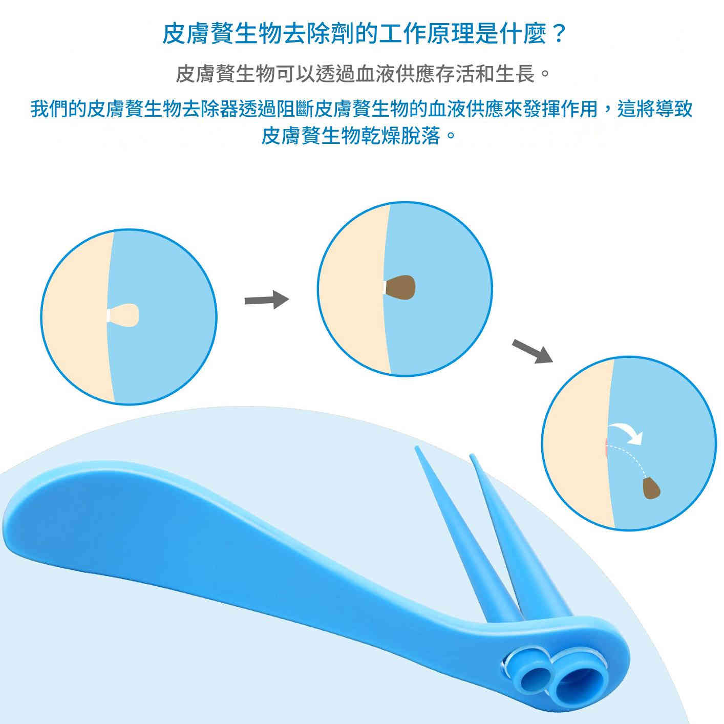 elaimei 2 合1 皮膚疣去除工具套件