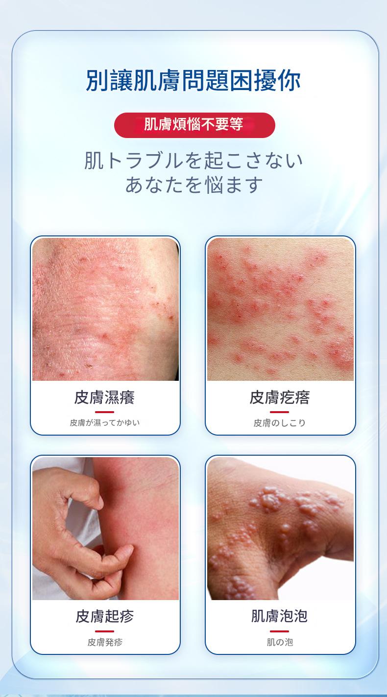 ( 日本 ) 秋雅奈緒止汗皰疹手足小水泡乾裂脫皮外用護理膏 30g/瓶x2 ( 日本 ) 秋雅奈緒止汗皰疹手足小水泡乾裂脫皮外用護理膏 30g/瓶