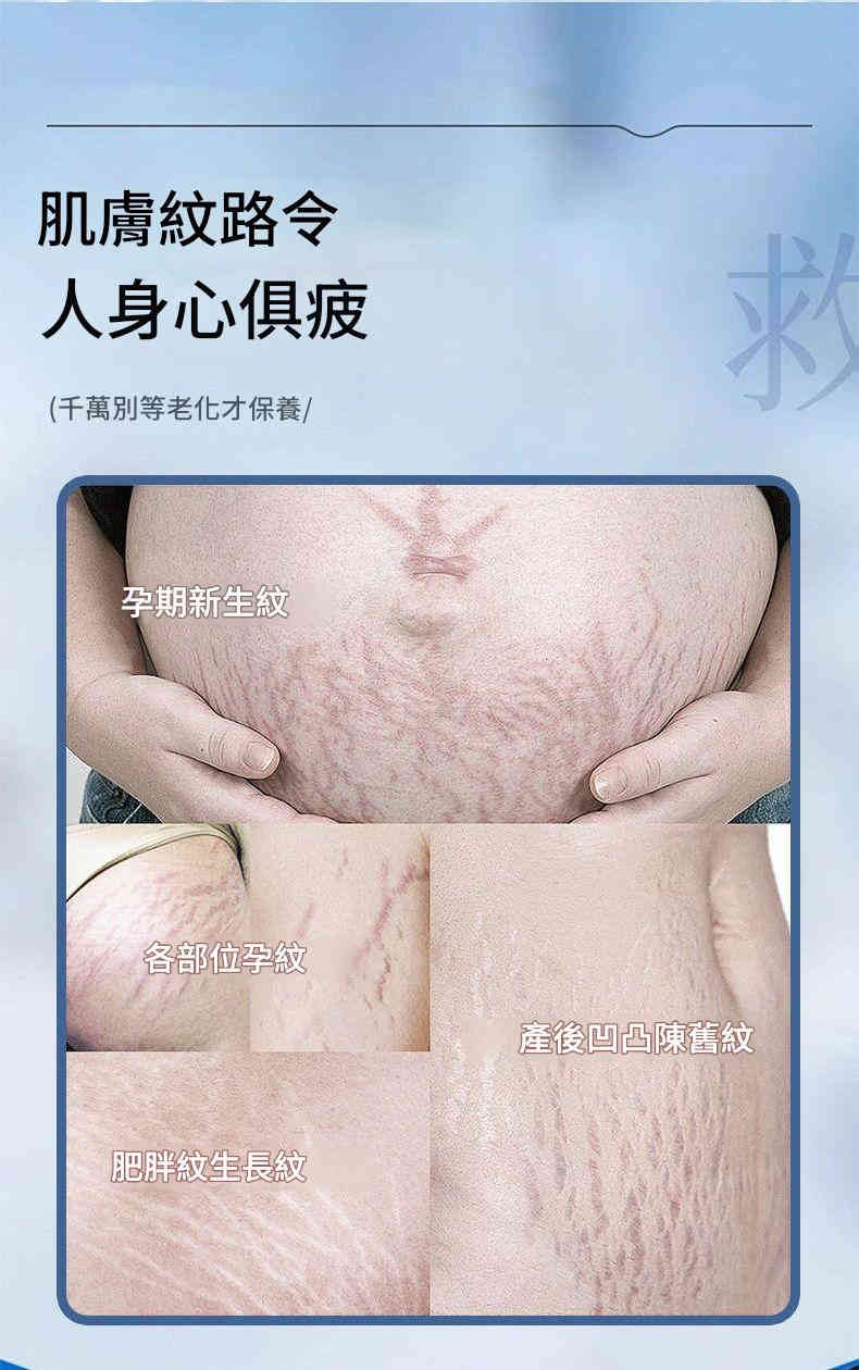 日本東京製藥特效腹部祛紋凝膠 20g/支x2