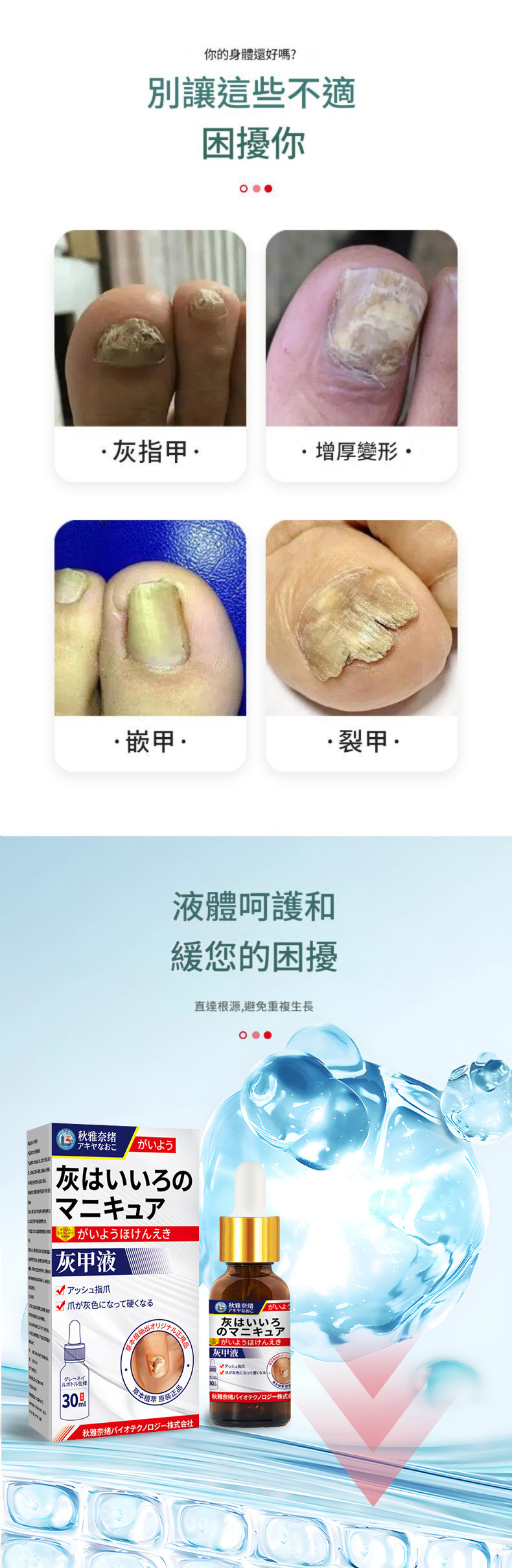 ( 日本 ) 秋雅奈緒灰指甲保手足指甲增厚亮護理液 30ml/瓶x2 ( 日本 ) 秋雅奈緒灰指甲保手足指甲增厚亮護理液 30ml/瓶x2