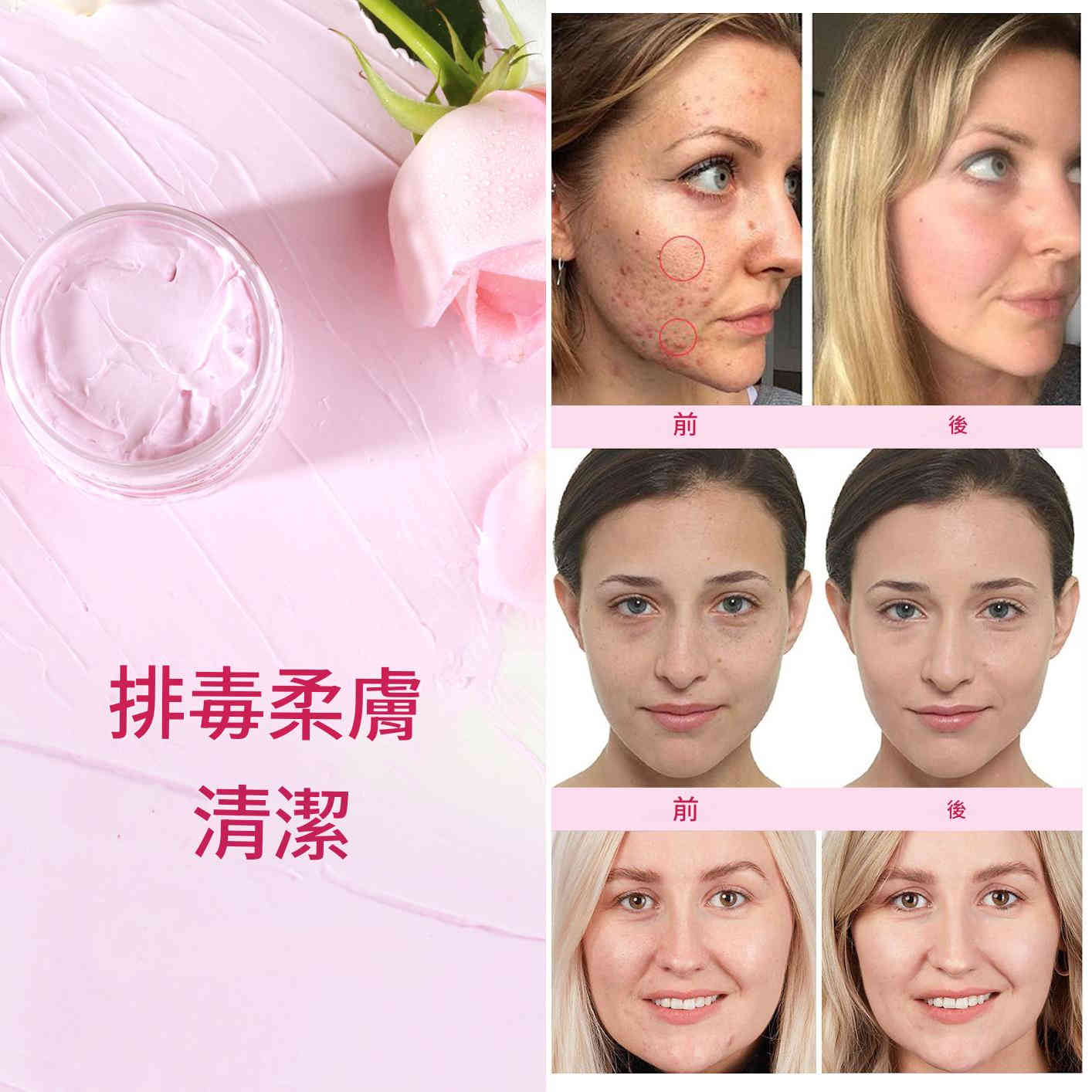 elaimei 薑黃蘆薈萃取物/花萃取物排毒保濕收緊毛孔面霜120g/盒