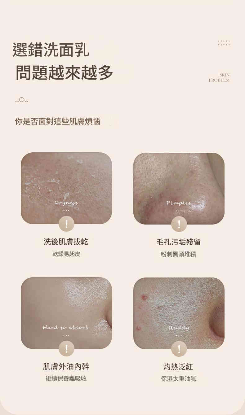 beiling mei 氨基酸控油祛痘去黑頭深層清潔洗面奶 100ml/瓶x2