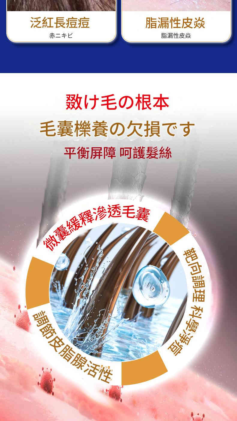 ( 日本 ) 秋雅奈緒煤焦油頭皮不適止痕癢洗髮精50ml/瓶x2