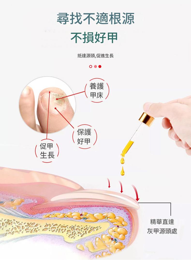 ( 日本 ) 秋雅奈緒灰指甲保手足指甲增厚亮護理液 30ml/瓶x2 ( 日本 ) 秋雅奈緒灰指甲保手足指甲增厚亮護理液 30ml/瓶x2