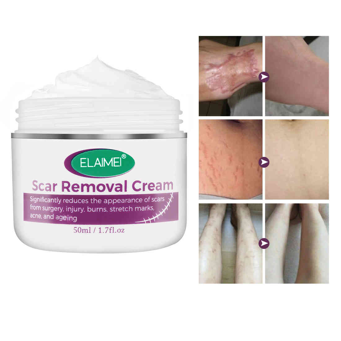 elaimei 積雪草提取物去疤痕膏50ml/盒