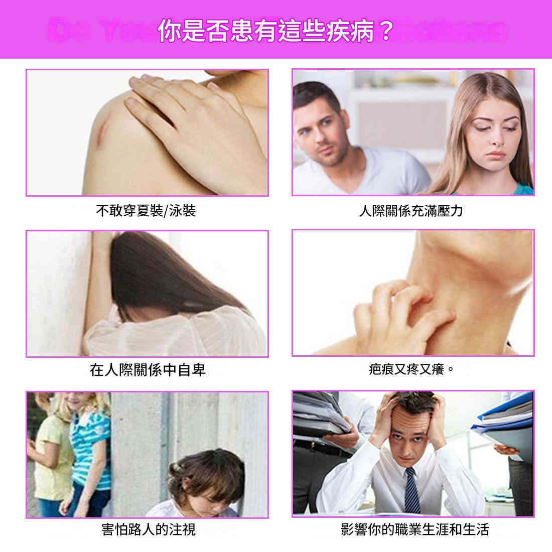 elaimei 積雪草提取物去疤痕膏50ml/盒