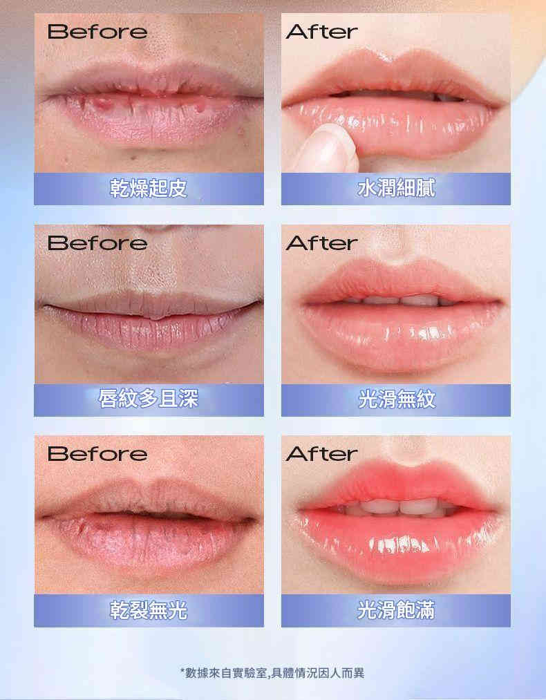 日本生物醫學研究院維生素b5唇部精華霜 20g/盒