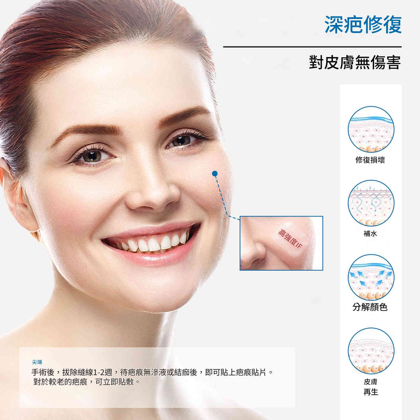 elaimei 專業醫療級透明矽膠疤痕貼x2