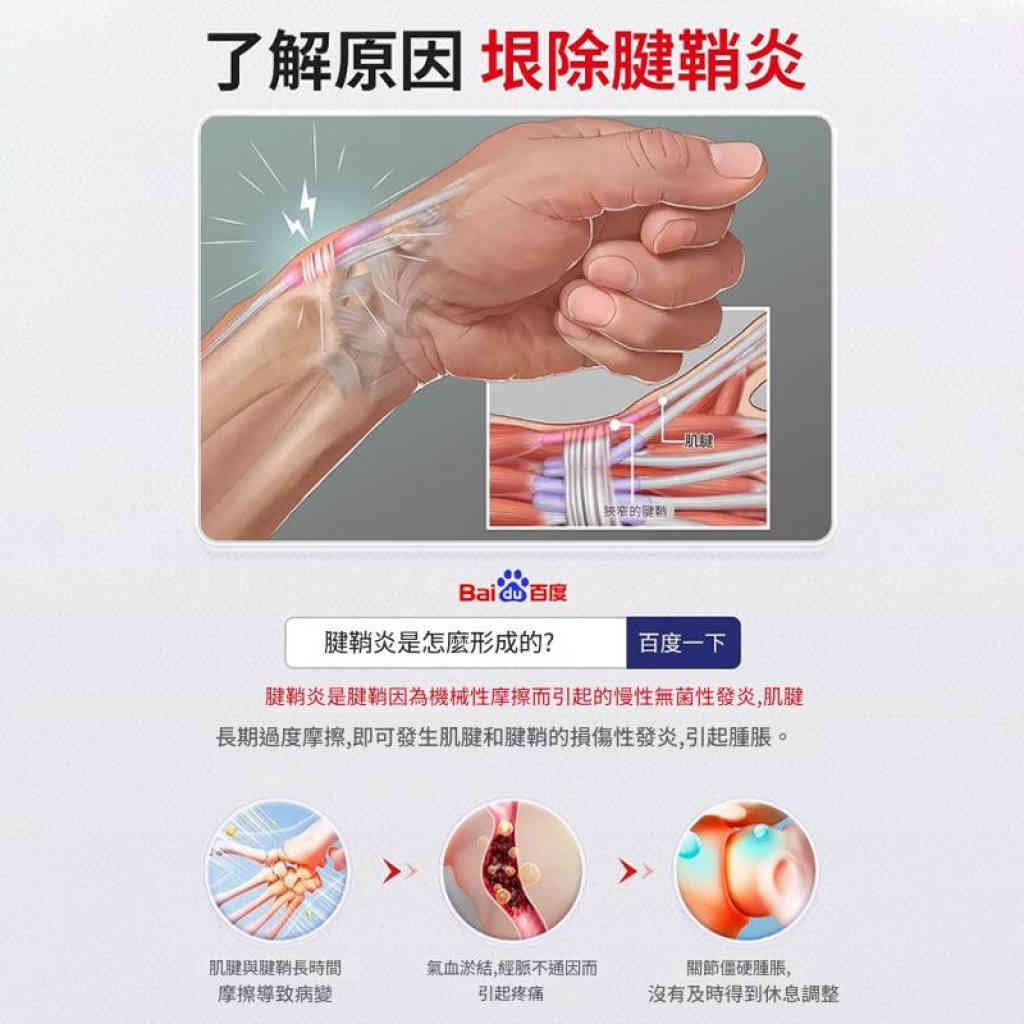 【久研製藥】腱鞘炎專效修復膏