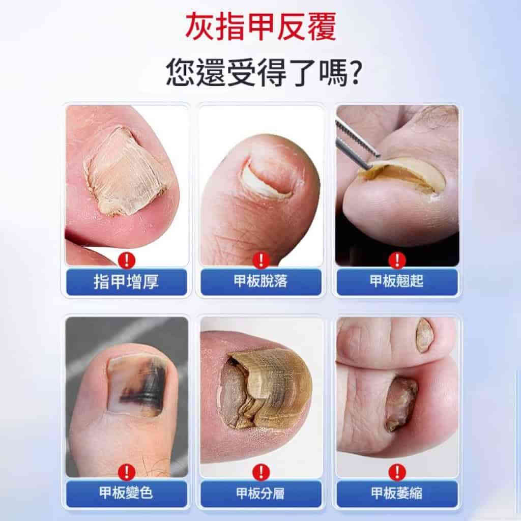 久研製藥 灰指甲一滴淨護理液