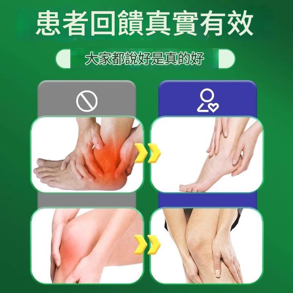 【專業舒緩】昃凜醫生痛風性關節疼痛噴劑