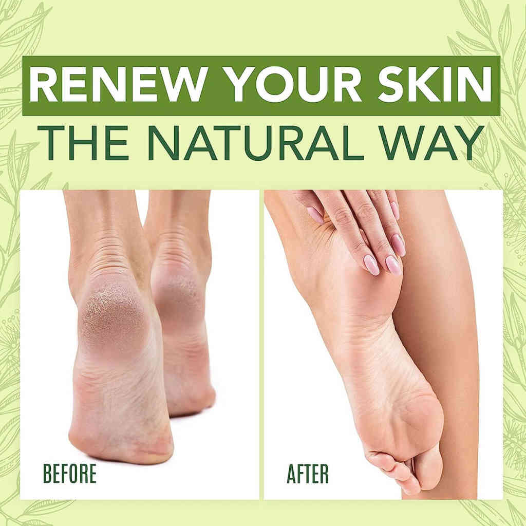 lanemay 茶樹精油護足霜50g/瓶