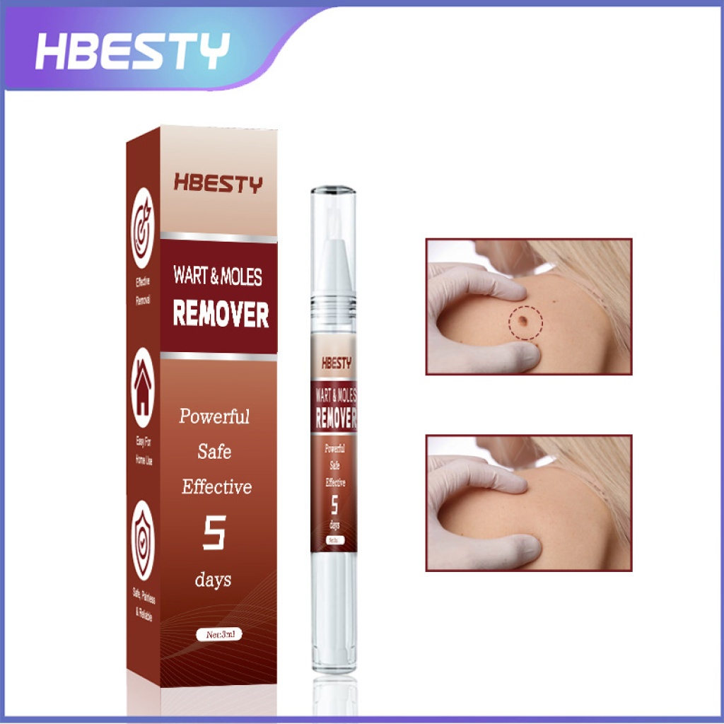 【hbesty 疣痣去除筆 3ml/支】5天見效！強效、安全、無痛，在家輕鬆去除疣、痣、肉贅