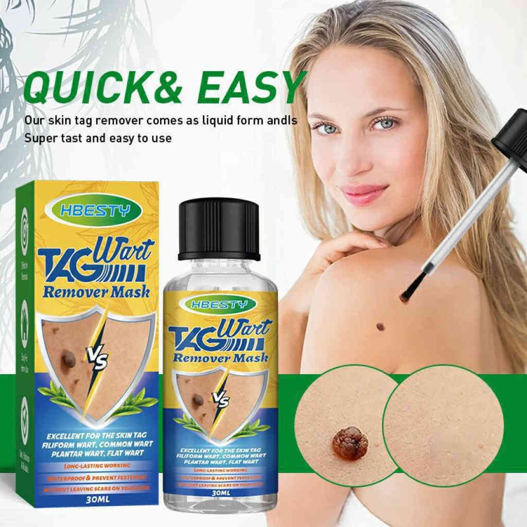 hbesty 專業去疣液 30ml/支｜快速清除皮膚贅生物，重現平滑潔淨肌膚