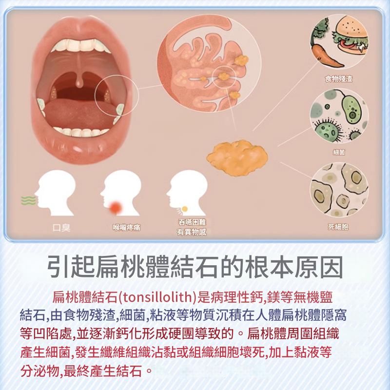 ( 日本 ） 井茂弘製藥扁桃體結石止痛楚噴劑 30ml/盒
