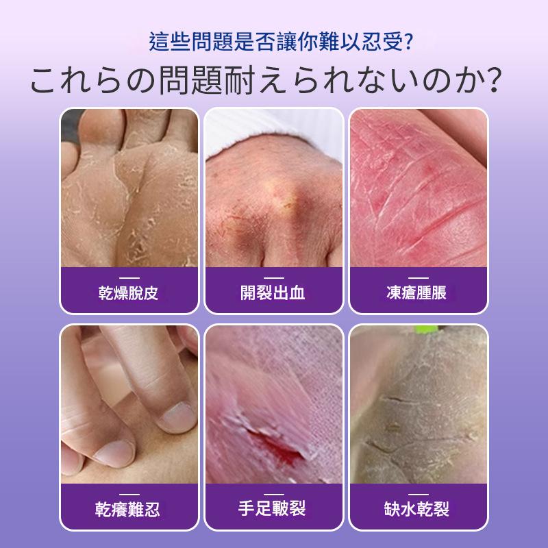 ( 日本 ) 岩井昃弘製特效濕疹藥保護膏 30g/盒