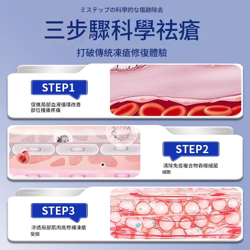 ( 日本 ) 岩井季弘制藥緩解和治療凍瘡特效止痛膏 30g