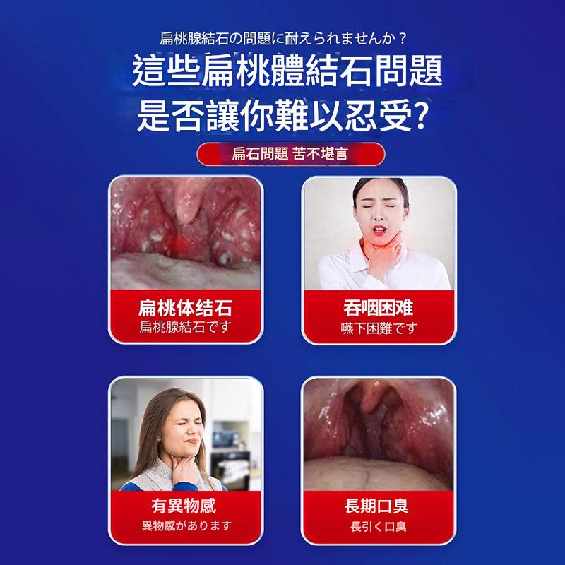 ( 日本 ） 井茂弘製藥扁桃體結石止痛楚噴劑 30ml/盒