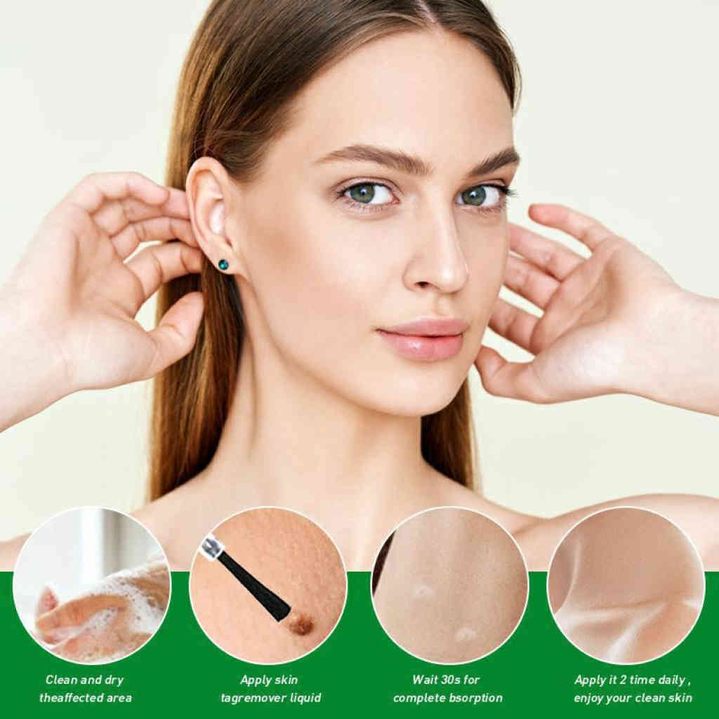 hbesty 專業去疣液 30ml/支｜快速清除皮膚贅生物，重現平滑潔淨肌膚