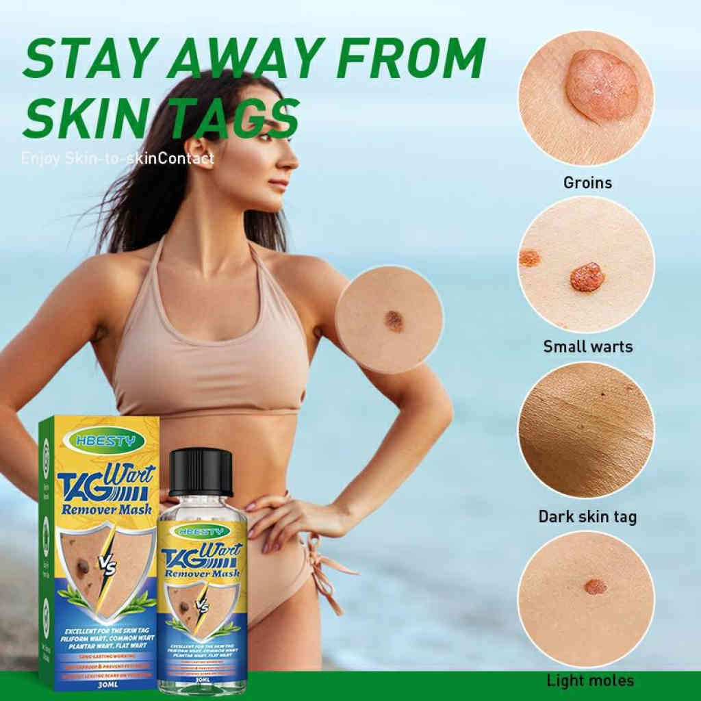 hbesty 專業去疣液 30ml/支｜快速清除皮膚贅生物，重現平滑潔淨肌膚