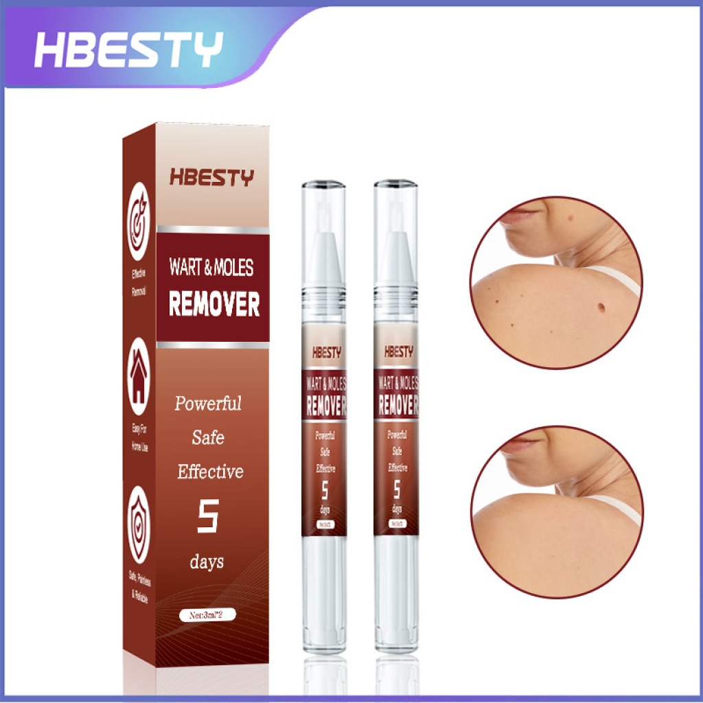 【hbesty 疣痣去除筆 3ml/支】5天見效！強效、安全、無痛，在家輕鬆去除疣、痣、肉贅